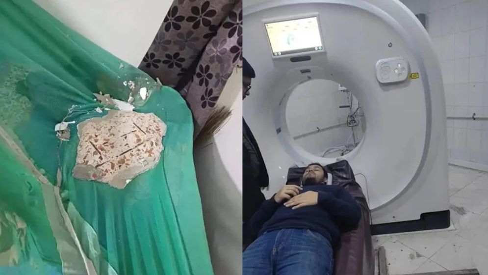 ঢাবির ঘুমন্ত শিক্ষার্থীর ওপর খসে পড়ল হলের ছাদের পলেস্তারা